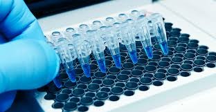 واکنش زنجیره ای پلیمراز (PCR)